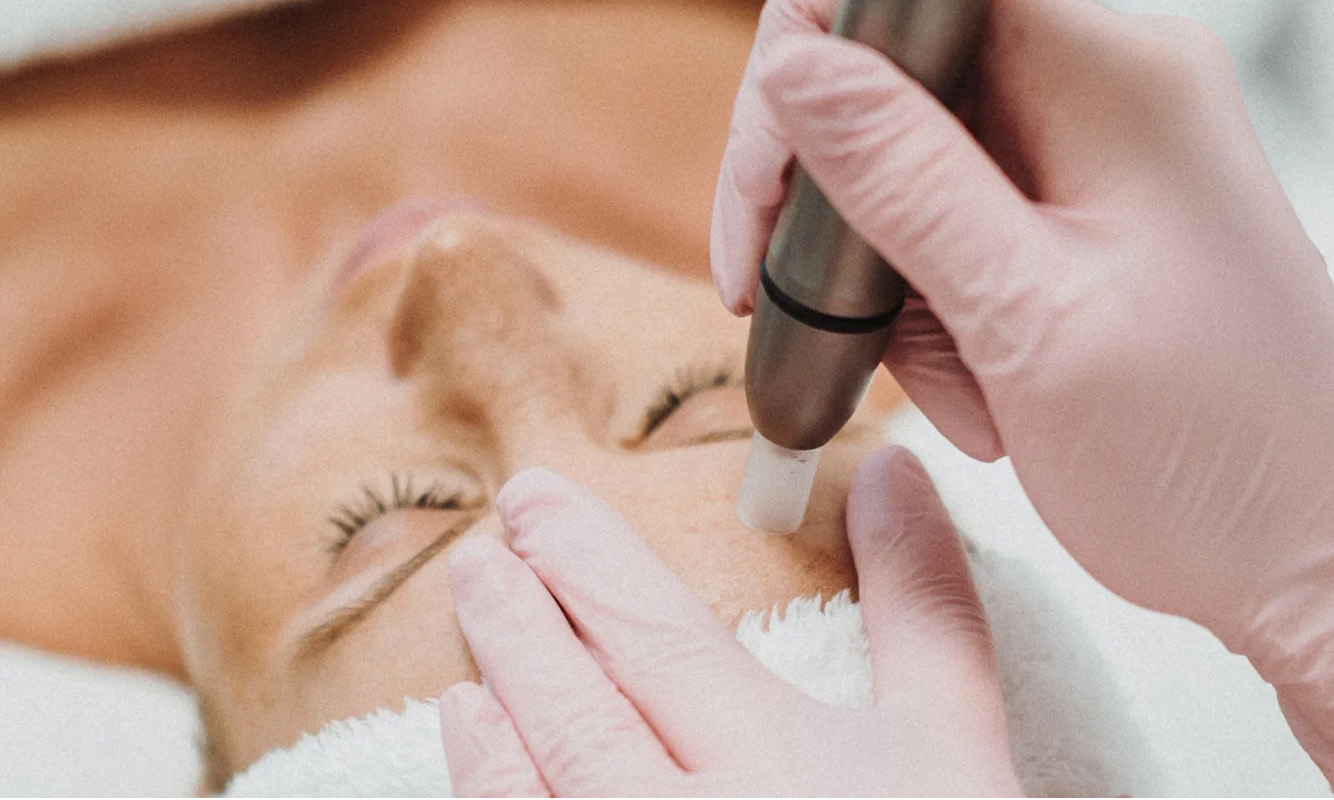 Microdermabrasion-Behandlung im Gesicht einer liegenden Kundin